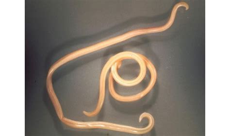 Parasitic Roundworm Has Its Genome Sequenced Asian Scientist Magazine