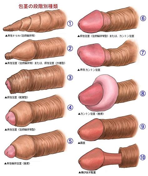 Different Dicks Shapes And Sizes