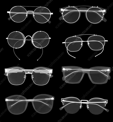 Sunglasses X Ray Stock Image F030 7043 Science Photo Library