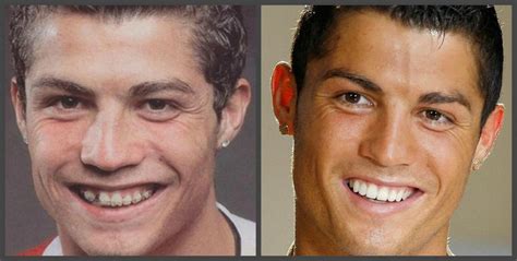 Cristiano Ronaldo Dientes antes y después una selección de fotos