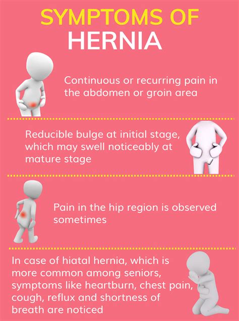 Hernia Symptoms Hiatal Hernia Other Common Symptoms Of Hernias Include