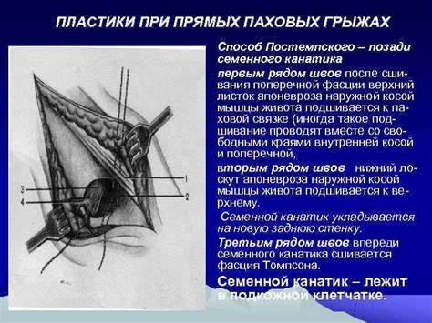 Послеоперационная диета грыжи Диета При Паховой Грыже До Операции — Похудение Диета Правильное Питание Диета При Паховой Грыже До Операции — Похудение Диета Правильное Питание Послеоперационная диета грыжи