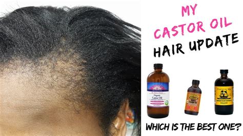 Best Castor Oil For Fast Hair Growth Youtube