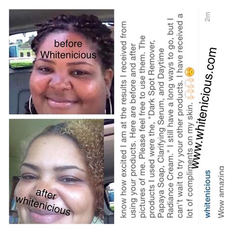“clientupdate We Love To Hear From You Whitenicious Skincare