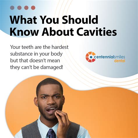 What You Should Know About Cavities Downtown Calgary Dentist