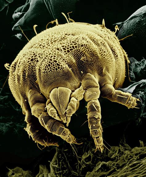 Wash Your Bedding To Get Rid Of Dust Mites Dust Mite Allergy Facts