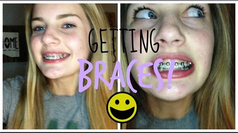 Getting My Braces On Youtube