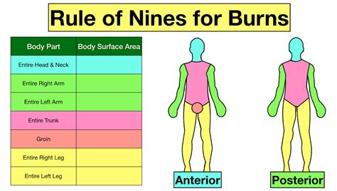 Rule Of Nines Picture Third Degree Burns Causes Symptoms And