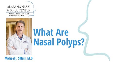 What Are Nasal Polyps Alabama Nasal And Sinus Center Birmingham Al