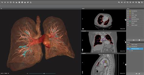 d2p dicom to print 3d systems