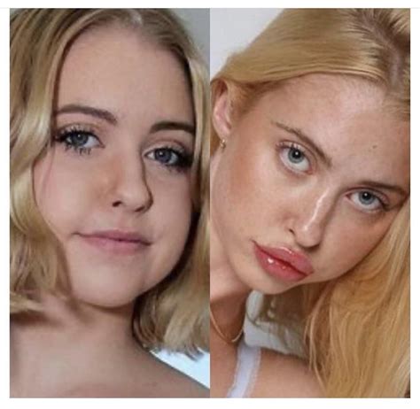 Chloe Cherry Before And After Pics R Redscarepod