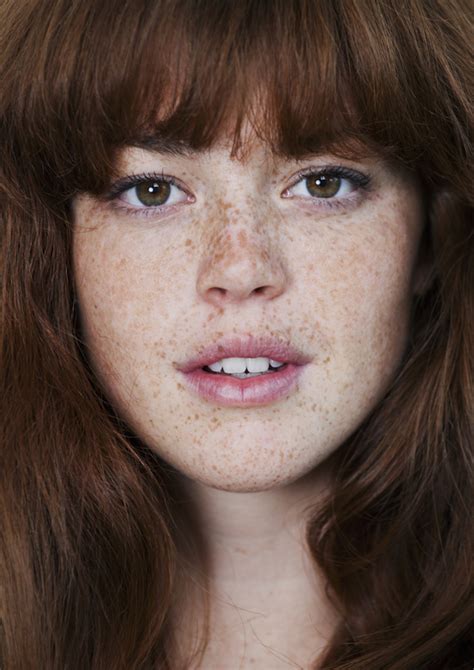 12 Problems Only Girls With Freckles Understand