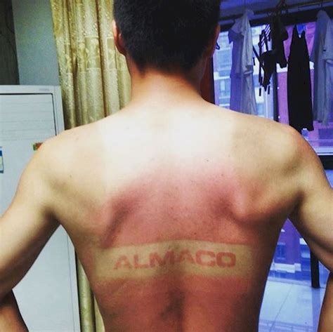 Hilarious Tan Lines That Ll Make You Never Want To Step Outside Again