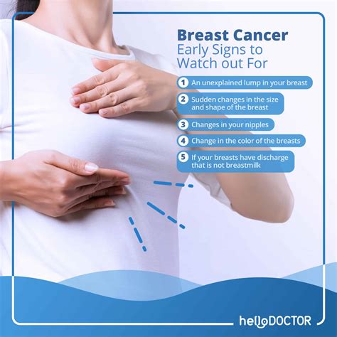 Thickening Or Lump In The Breast Or Elsewhere Is It Breast Cancer