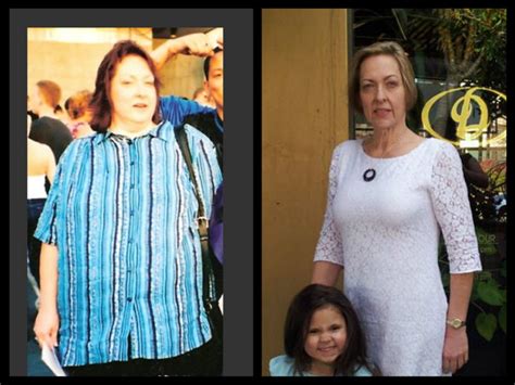 Real Weight Loss Success Stories I Lost 215 Pounds To Save My Life