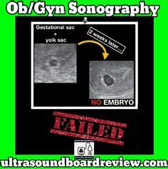 Ob Gyn Sonography Registry Review Ideas Sonography Ultrasound