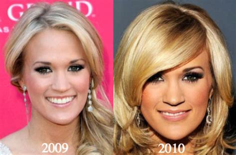 Carrie Underwood Plastic Surgery Before And After Photos Latest