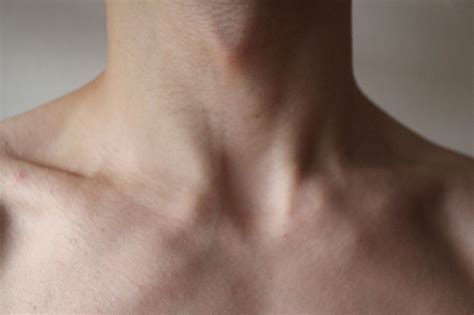 Are Lymph Nodes In The Collarbone Dangerous Vinmec