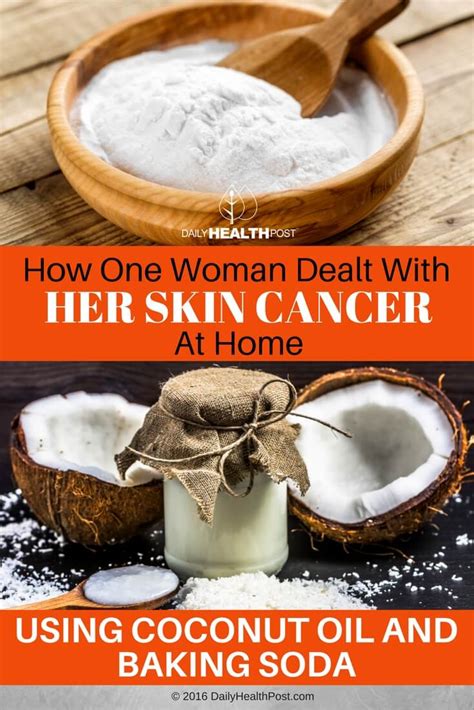 This helps conduct the heat from the burners through the fish. How One Woman Dealt With Her Skin Cancer At Home - Using ...