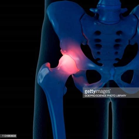 Male Pelvic Pain Photos And Premium High Res Pictures Getty Images