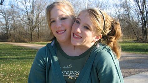 What The Famous Conjoined Twins Abby And Brittany Hensel Are Up To