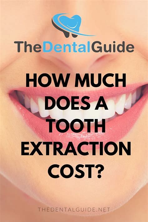 How Much Does A Tooth Extraction Cost The Dental Guide