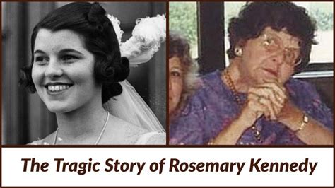 Rosemary Kennedy The Tragic Legacy Of Lobotomy Youtube
