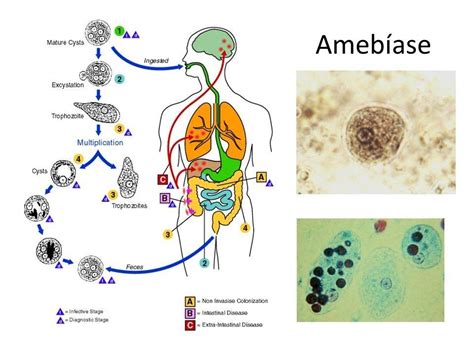 Amebas O Que São Características Amebíase E Prevenção