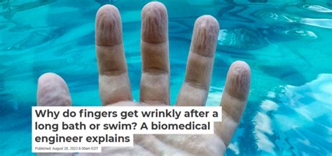 Why Do Fingers Get Wrinkly After A Long Bath Or Swim A Biomedical Engineer Explains Life And