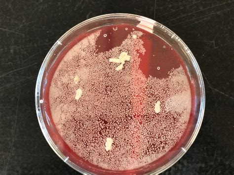 Listeria is known to veterinarians since the early 1900s all pathogenic strains of listeria (l. Isolating Listeria Monocytogenes in Food Sample