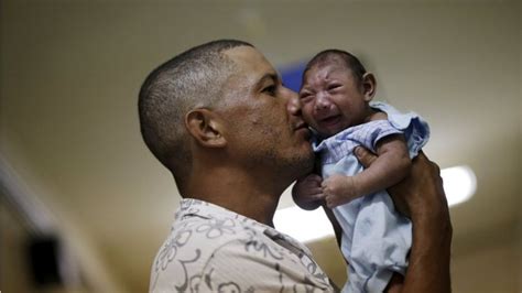 Zika Virus And Microcephaly Your Questions Answered Bbc News
