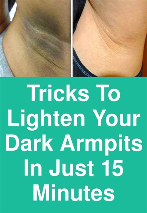 Tricks To Lighten Your Dark Armpits In Just 15 Minutes Whenever We Try