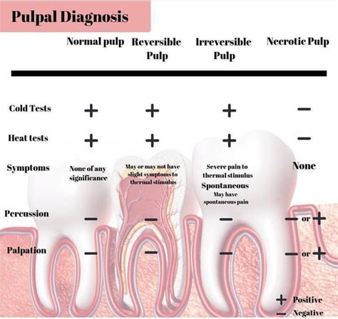 Pulpal Diagnosis Restorative Dentistry Dental Assistant Study Dentistry
