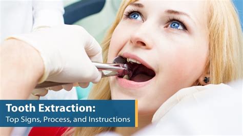 Tooth Extraction Top Signs Process And Instructions Dripiv Plus
