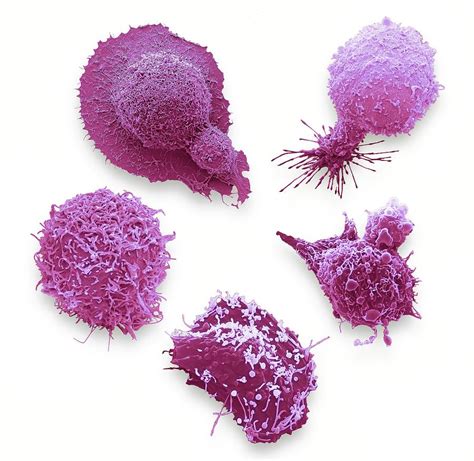 Cells From The Most Common Male Cancers Photograph By Steve