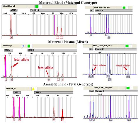 Ijms Free Full Text Multiplex Pcr For 17 Y Chromosome Specific Short Tandem Repeats Str To