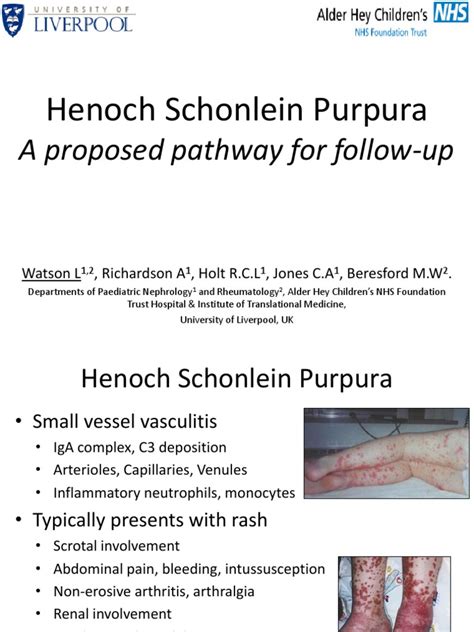 Henoch Schonlein Purpura Clinical Medicine Health Care