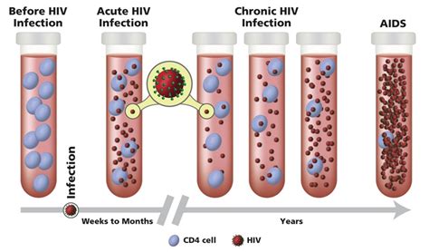The Stages Of Hiv Infection Nih