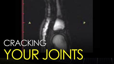 What Happens When You Crack Your Joints Youtube