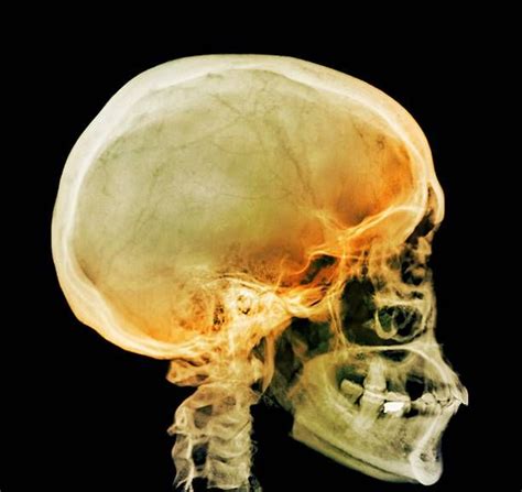 Human Skull Profile Stock Pictures Royalty Free Photos And Images