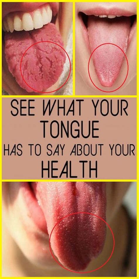Look At Your Tongue And See What It Has To Say About Your Health