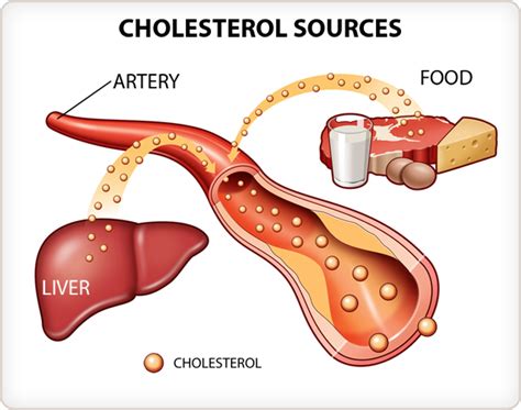 Cholesterol Basics Slo Niacin