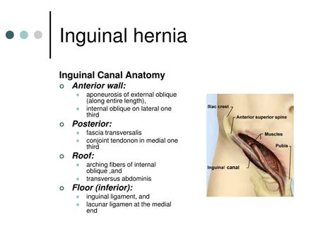 Ppt Hernias Powerpoint Presentation Id679255