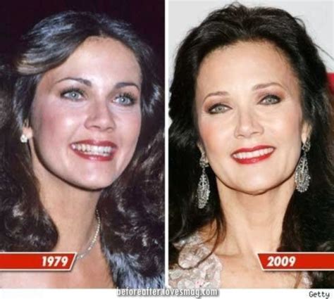 Fantastic Lynda Carter Cosmetic Surgery Earlier Than And After Images