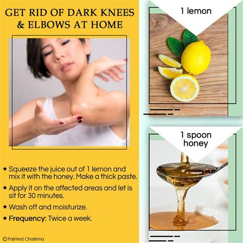 Home Remedies To Get Rid Of Dark Knees And Elbows Diy Skin Remedies
