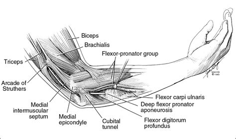 Cubital Tunnel Syndrome Current Concepts Jaaos Journal Of The