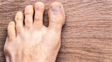 this is why your toes cramp while you run