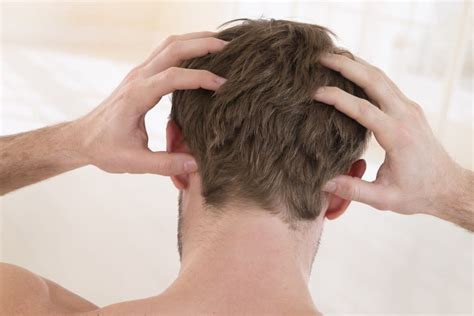 Scalp Build Up Causes Of Scalp Buildup And How To Treat It
