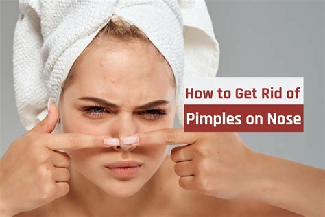How To Get Rid Of Pimples On Nose Home Remedies How To Cure