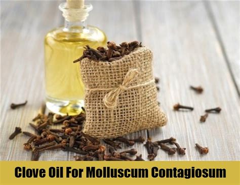5 Natural Cures For Molluscum Contagiosum How To Cure Molluscum